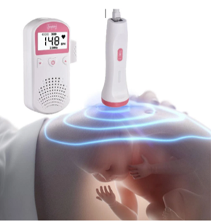 MONITOR DE FRECUENCIA CARDIACA FETAL